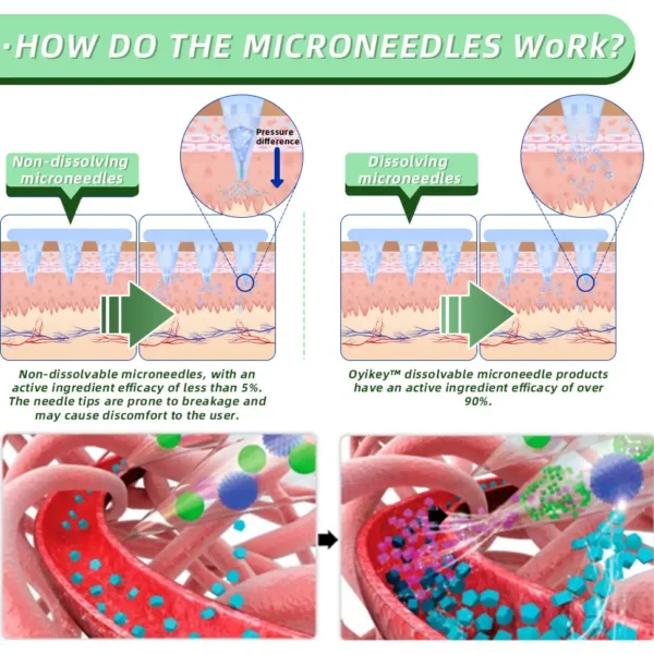 LOVILDS™ SMGT-GLP-1 Nano Microneedle Patch
