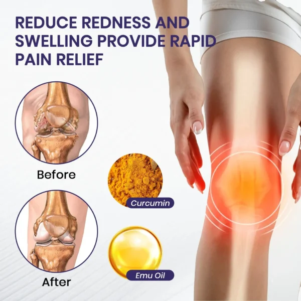 LOVILDS™ Turmeric & Emu Oil Arthritis Soothing Pain Relief Massage Gel