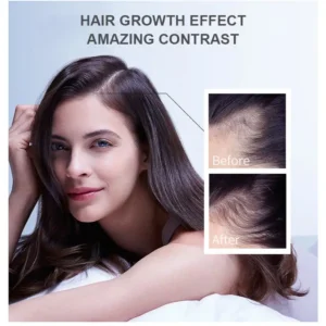 LOVILDS™ Hair Growth Essence