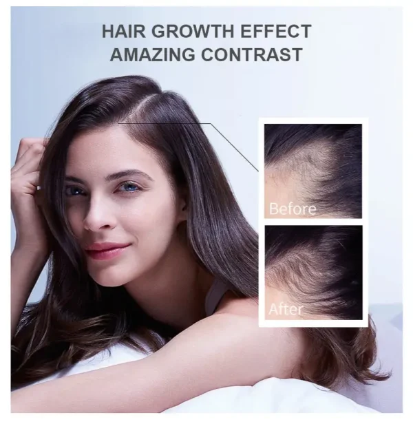 LOVILDS™ Hair Growth Essence