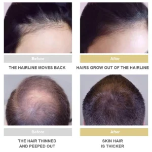 LOVILDS™ Hair Growth Essence