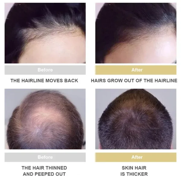 LOVILDS™ Hair Growth Essence