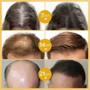 LOVILDS™ Hair Growth Essence