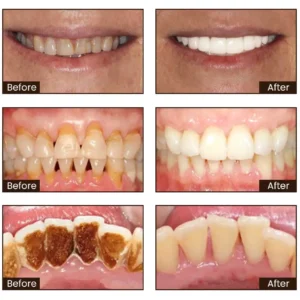 LOVILDS™ Nicotinamide Whitening Toothpaste