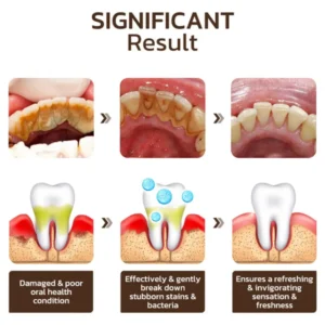 LOVILDS™ Nicotinamide Whitening Toothpaste