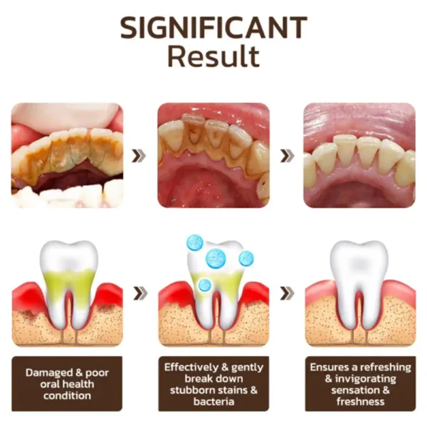 LOVILDS™ Nicotinamide Whitening Toothpaste