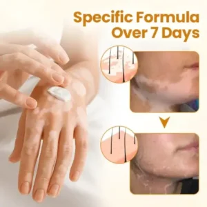 Lovilds® VitiCalm Bee Toxin Cream