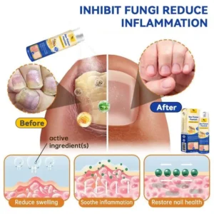LOVILDS™ PsoriaHeal psoriasis Spray