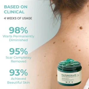 LOVILDS™ Ultra NatureErase Instant Mole & Spot Removal Gel