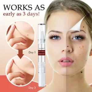 🔥 🔥🔥Final 3 Hours: 60% OFF Lovilds™ Tags & Moles Remover