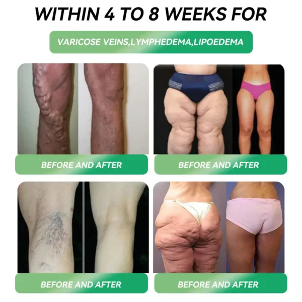 🌿 LOVILDS™ SMGT-GLP-1 Nano Microneedle Patch – 24-Hour Pain-Free Weight Loss & Blood Sugar Control 💪✨