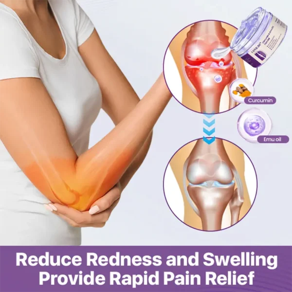 (🔥LAST DAY SALE - 80% OFF) LOVILDS™ Curcumin & Emu Oil Pain Gel – 🏥Backed by US Osteopathic Experts