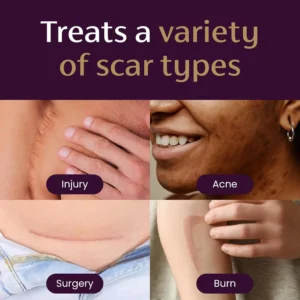 LOVILDS® Advanced Scar Gel