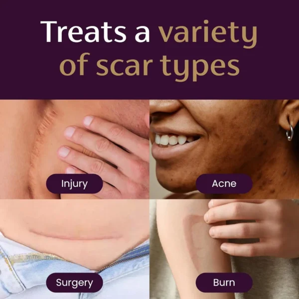 LOVILDS® Advanced Scar Gel