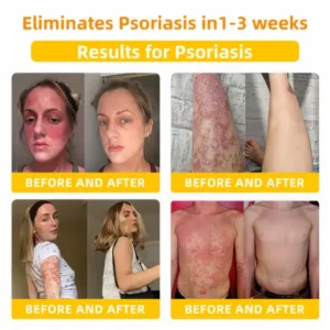 LOVILDS™ Bee Toxin Skin Repair Cream(AAD Recommended👨‍⚕️)