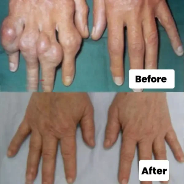 LOVILDS™ Bee Venom Professional Healing Gel