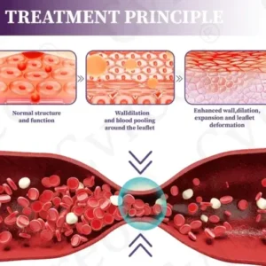 LOVILDS™ Care Phyto Cream-HelpsTreat Varicose Veins,Swelling,cramps and Leg Pain