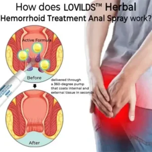 LOVILDS® Herbal Hemorrhoid Treatment Anal Spray Pro