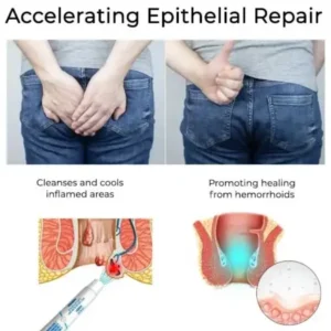LOVILDS® Herbal Hemorrhoid Treatment Anal Spray Pro