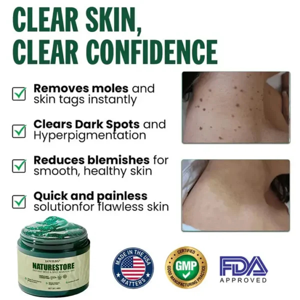 LOVILDS® Instant Mole & Spot Gel