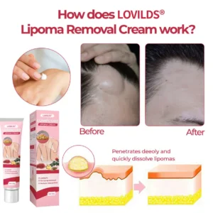 LOVILDS® LumpCure Lipoma Cream 🔥 SUMMER SALE 60%