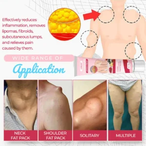LOVILDS® LumpCure Lipoma Cream 🔥 SUMMER SALE 60%