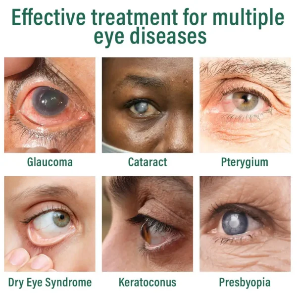 👩‍⚕️LOVILDS™ Nano Eye Drops Serum ✅FDA Approved(Suitable for presbyopia, dry eye syndrome, glaucoma, and cataracts) 👀
