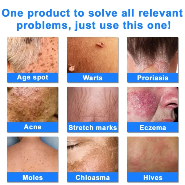 LOVILDS®  OatCalm Skin Repair Cream Rx