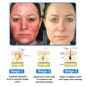 LOVILDS®  OatCalm Skin Repair Cream Rx