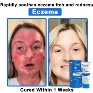 LOVILDS®  OatCalm Skin Repair Cream Rx