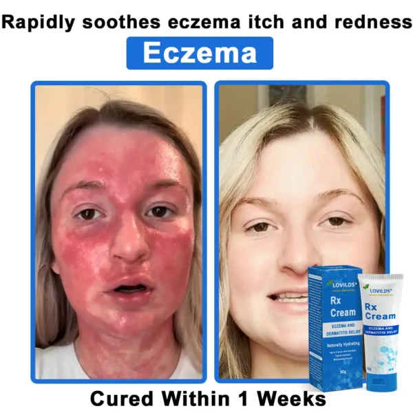 LOVILDS®  OatCalm Skin Repair Cream Rx