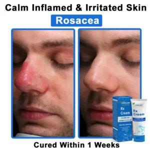 LOVILDS®  OatCalm Skin Repair Cream Rx