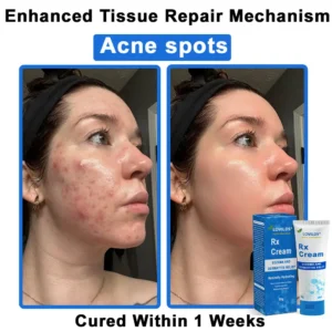 LOVILDS®  OatCalm Skin Repair Cream Rx