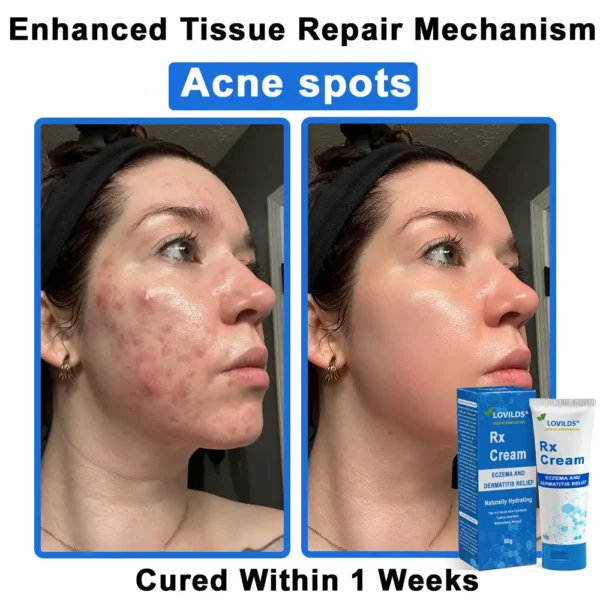 LOVILDS®  OatCalm Skin Repair Cream Rx