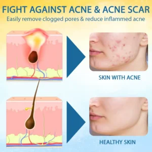 LOVILDS™ Psoriasis Care Mellifera Venom Skin Healing Spray🐝〰️