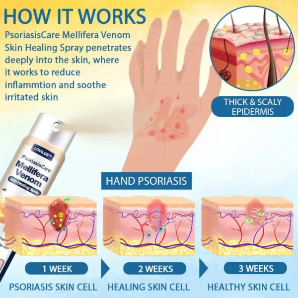LOVILDS™ Psoriasis Care Mellifera Venom Skin Healing Spray🐝〰️
