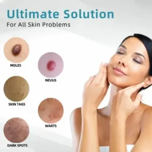 LOVILDS® VelvetSkin+ All-in-One Laser Eraser Pen