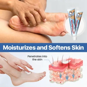 LOVILDS™ VitaGluco Diabetes Treatment Cream -👨‍⚕️ American Academy of Dermatology(AAD) Approved