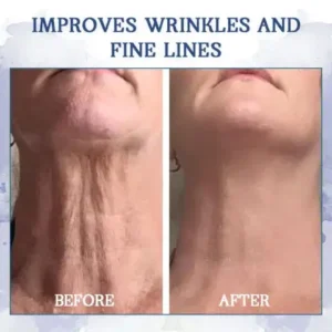 ✨Last Day Discount: 87% OFF🌸LOVILDS® Advanced Firming & Wrinkle-Reducing Cream: Restore Skin Elasticity⭐