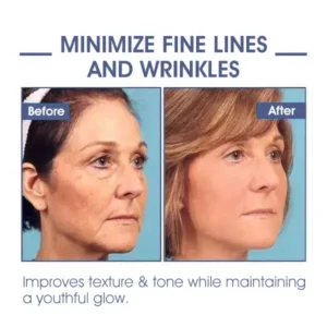 ✨Last Day Discount: 87% OFF🌸LOVILDS® Advanced Firming & Wrinkle-Reducing Cream: Restore Skin Elasticity⭐