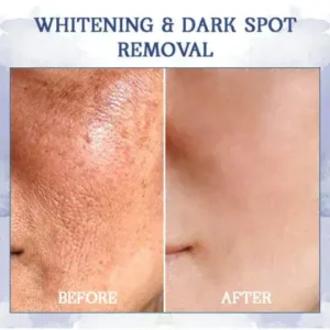 ✨Last Day Discount: 87% OFF🌸LOVILDS® Advanced Firming & Wrinkle-Reducing Cream: Restore Skin Elasticity⭐