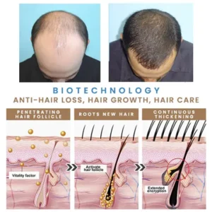 Last Day Promotion 70% OFF - 🔥Put an end to hair loss with LOVILDS™ Hair Growth Serum!