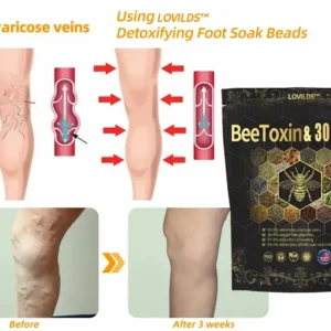 Last day to get 70% OFF: Lovilds™ Bee Toxin & 30-Herb Detox Foot Soak Beads for Body Sculpting- Recommended by the America Lymphatic Academy (ALA) 🧀