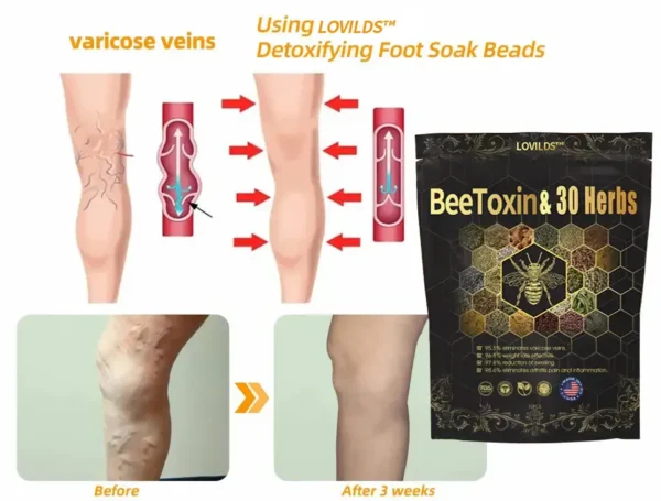 Last day to get 70% OFF: Lovilds™ Bee Toxin & 30-Herb Detox Foot Soak Beads for Body Sculpting- Recommended by the America Lymphatic Academy (ALA) 🧀