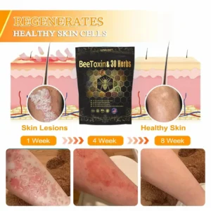 Last day to get 70% OFF: Lovilds™ Bee Toxin & 30-Herb Detox Foot Soak Beads for Body Sculpting- Recommended by the America Lymphatic Academy (ALA) 🧀
