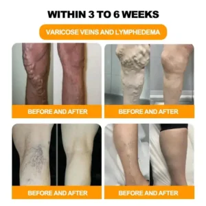 Last day to get 70% OFF: Lovilds™ Bee Toxin & 30-Herb Detox Foot Soak Beads for Body Sculpting- Recommended by the America Lymphatic Academy (ALA) 🧀