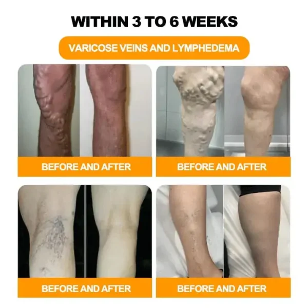 Last day to get 70% OFF: Lovilds™ Bee Toxin & 30-Herb Detox Foot Soak Beads for Body Sculpting- Recommended by the America Lymphatic Academy (ALA) 🧀