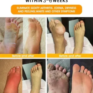 Last day to get 70% OFF: Lovilds™ Bee Toxin & 30-Herb Detox Foot Soak Beads for Body Sculpting- Recommended by the America Lymphatic Academy (ALA) 🧀