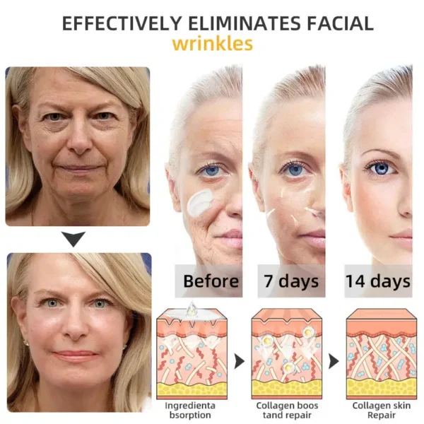 💐💞Lovilds™ BeeLift Anti-Aging Firming Cream,Address Crepe & Sagging(🔥74% Off for a Limited Time!)
