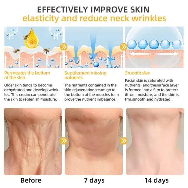 💐💞Lovilds™ BeeLift Anti-Aging Firming Cream,Address Crepe & Sagging(🔥74% Off for a Limited Time!)